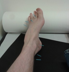 Akupunktur Fuß